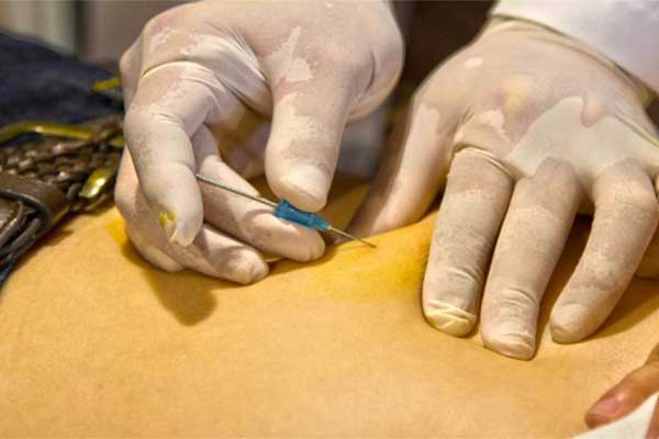 مزایای نخ لاغری شکم